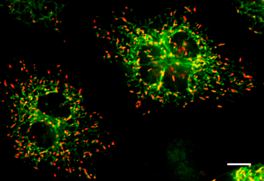 Une nouvelle cible pour le diagnostic et le traitement du sepsis et du choc septique