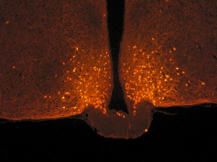 A l’origine de la satiété, des cellules du cerveau qui changent de forme après un repas