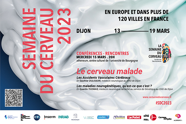 La Semaine du Cerveau à l’uB : le programme est en ligne !